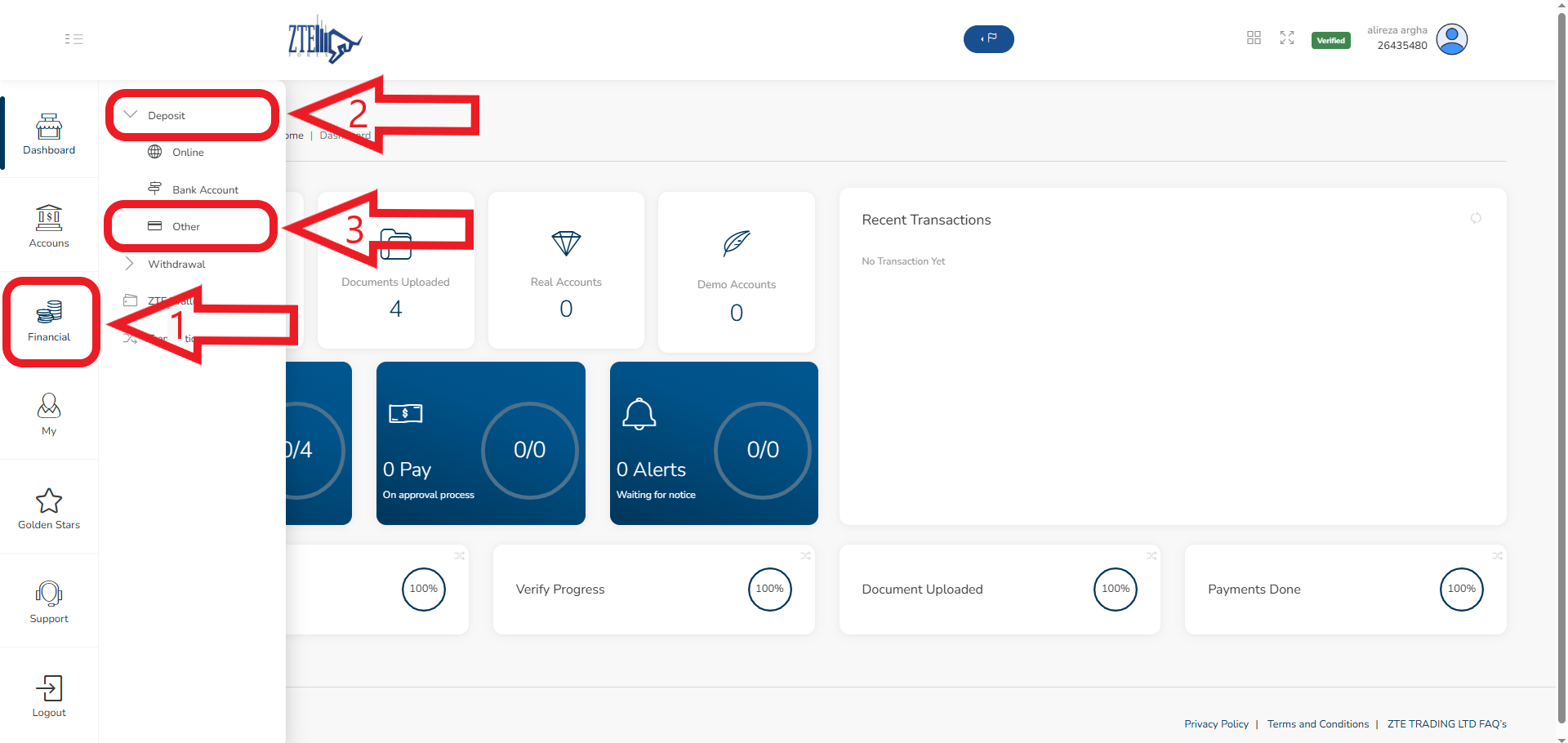 مرحله واریز دربروکر ZTE 